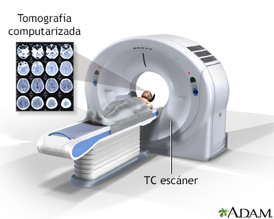 Obtener una visualización detallada de la anatomía del paciente  a partir de múltiples determinaciones de absorción de RX.